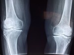Leg Health: Often Overlooked, But Vital To&nbsp;Wellbeing
